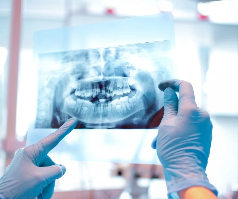 radiologia-odontologica-utp-1